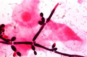 O fungo Candida albicans